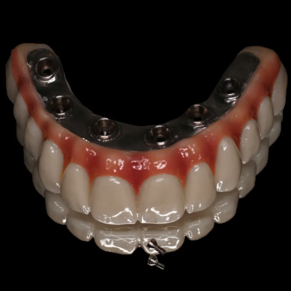 TITANIUM BAR SYSTEM